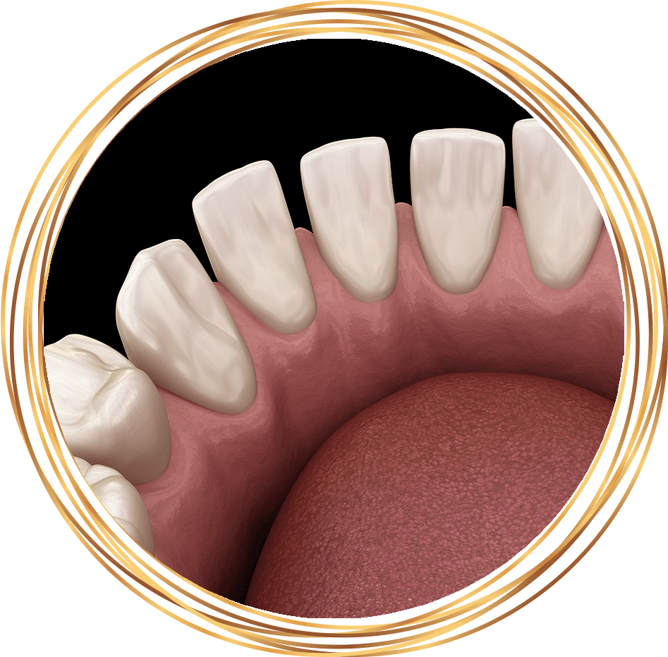 gapped teeth