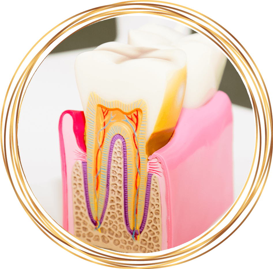 tooth roots in dental model